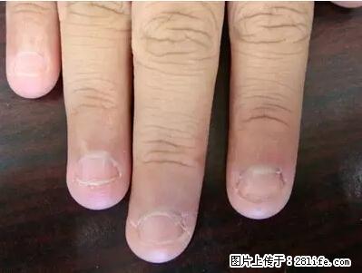 剪指甲、挖耳屎，这些日常小动作竟隐藏大危害！ - 阿克苏生活资讯 - 阿克苏28生活网 aks.28life.net